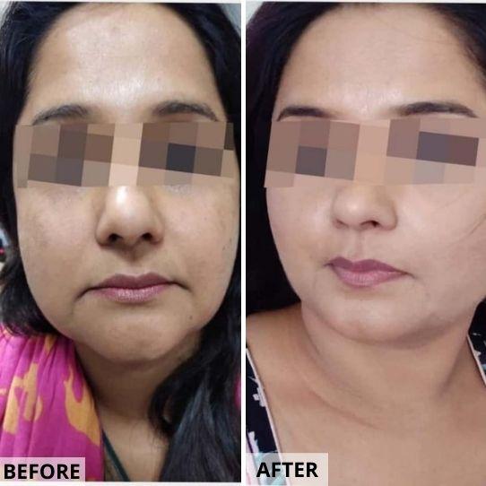 Anti-Aging Makeover